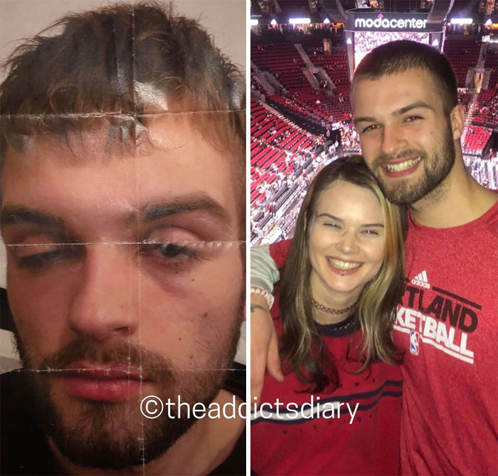 Addicts-Diary-Before-After-Photo