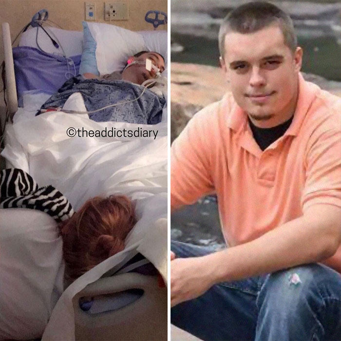 Addicts-Diary-Before-After-Photo