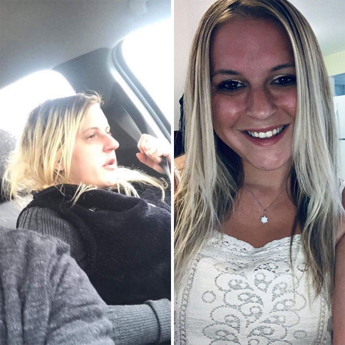 Addicts-Diary-Before-After-Photo