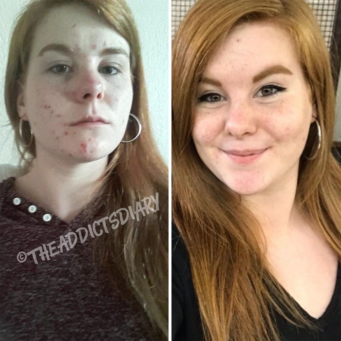 Addicts-Diary-Before-After-Photo
