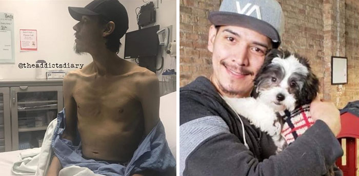 Addicts-Diary-Before-After-Photo