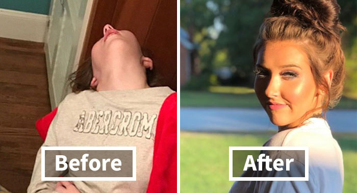 ‘The Addict’s Diary’ Showcases Before & After Transformations Of People Who Quit Drugs (30 Stories)