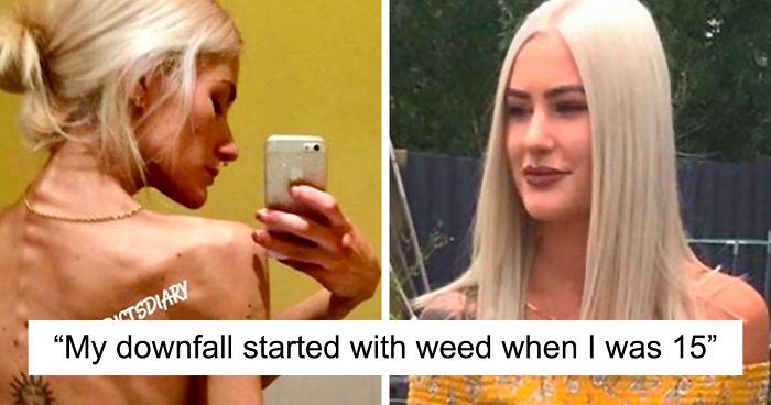 ‘The Addict’s Diary’ Showcases Before & After Transformations Of People Who Quit Drugs (30 Stories)