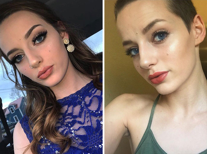 I Donated/Raised $600 For Children's Cancer Research For Shaving My Head, Here's My Transformation So Far