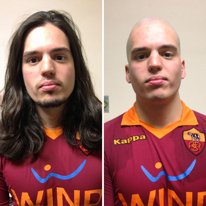 I Decided To Cut My Hair And Donate It So It Can Be Used To Make A Wig For A Cancer Patient That Has Gone Through Chemo