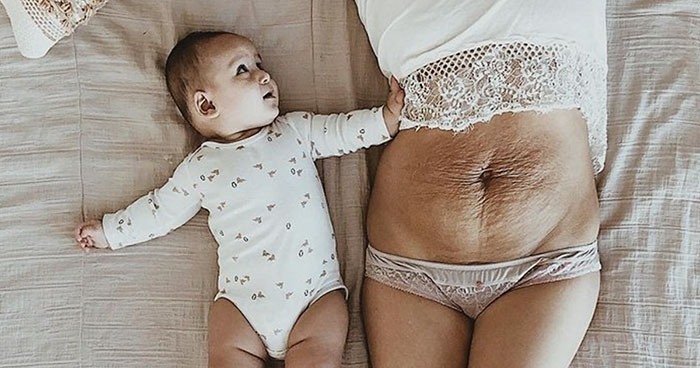 Mom Of 5 Shares Her Belly Photo To Celebrate The Beauty Of Woman Body