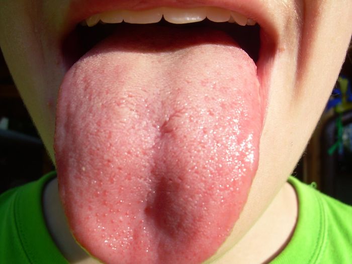 All Different Tastes Can Be Detected On All Parts Of The Tongue By Taste Buds