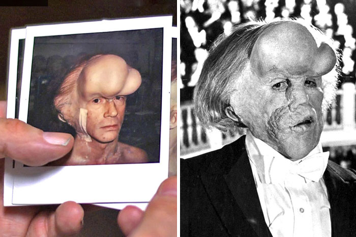 John Hurt, The Elephant Man