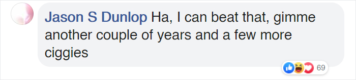 Surgeons Show What The Human Lungs Look Like After 30 Years Of Smoking & It's Shocking