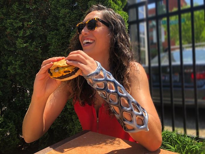 Engineers Create A Breathable And Waterproof Cast To Replace Plaster Ones And Stop The Itching Forever