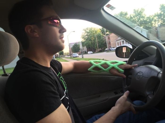 Engineers Create A Breathable And Waterproof Cast To Replace Plaster Ones And Stop The Itching Forever Engineers Create A Breathable And Waterproof Cast To Replace Plaster Ones And Stop The Itching Forever