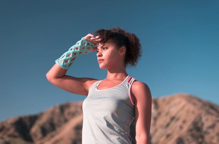 Engineers Create A Breathable And Waterproof Cast To Replace Plaster Ones And Stop The Itching Forever