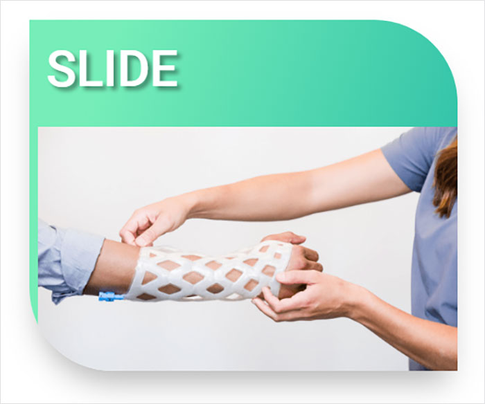 Engineers Create A Breathable And Waterproof Cast To Replace Plaster Ones And Stop The Itching Forever Engineers Create A Breathable And Waterproof Cast To Replace Plaster Ones And Stop The Itching Forever