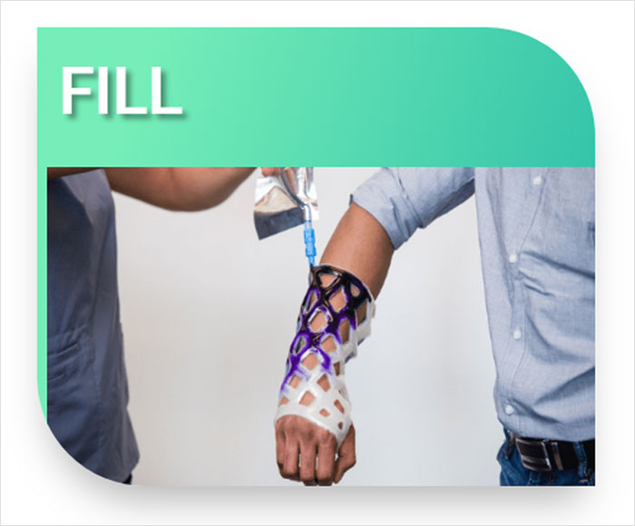 Engineers Create A Breathable And Waterproof Cast To Replace Plaster Ones And Stop The Itching Forever