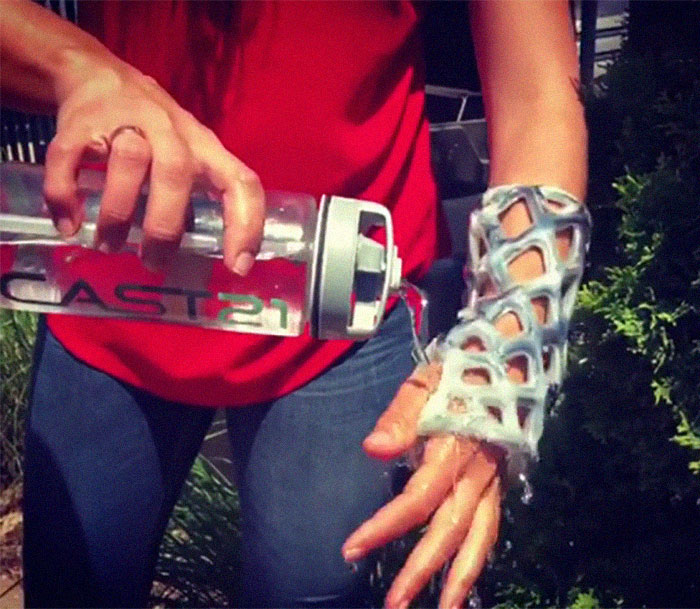 Engineers Create A Breathable And Waterproof Cast To Replace Plaster Ones And Stop The Itching Forever