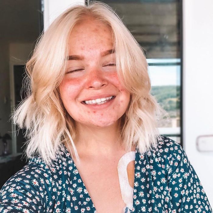 She's My Favorite! So Gorgeous And Honest As Hell About Everything From Body Image, To Bad Skin, To Health Issues