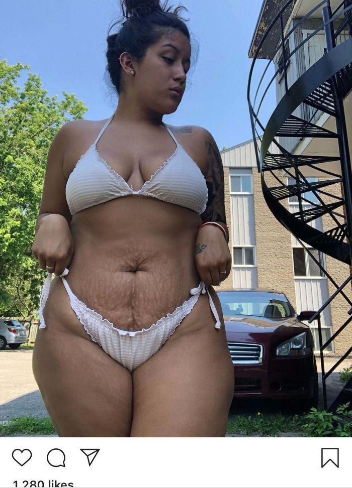 Obtainable Body Goals, Real Skin, Truly Beautiful!