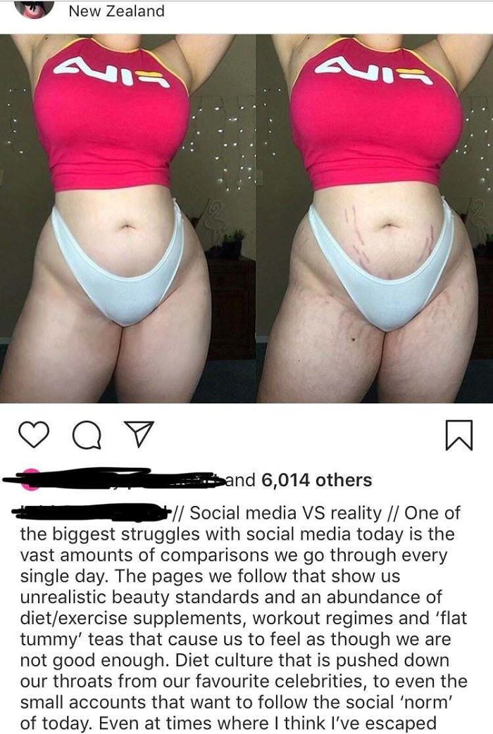 Sick Of Stretch Marks Being Erased, Especially On Plus Size Bodies! Let’s Normalise Them Pls