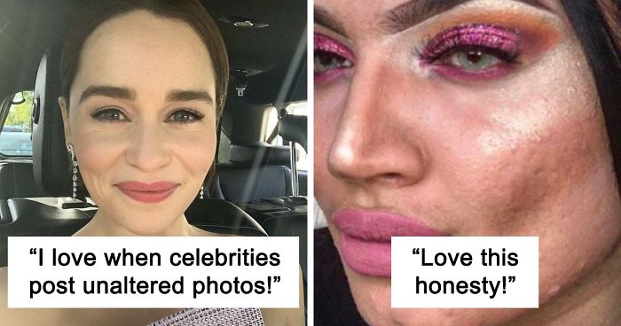 30 Times Instagrammers Showed The World Their ‘Real’ Bodies, And The Internet Admired Their ‘Sanity’