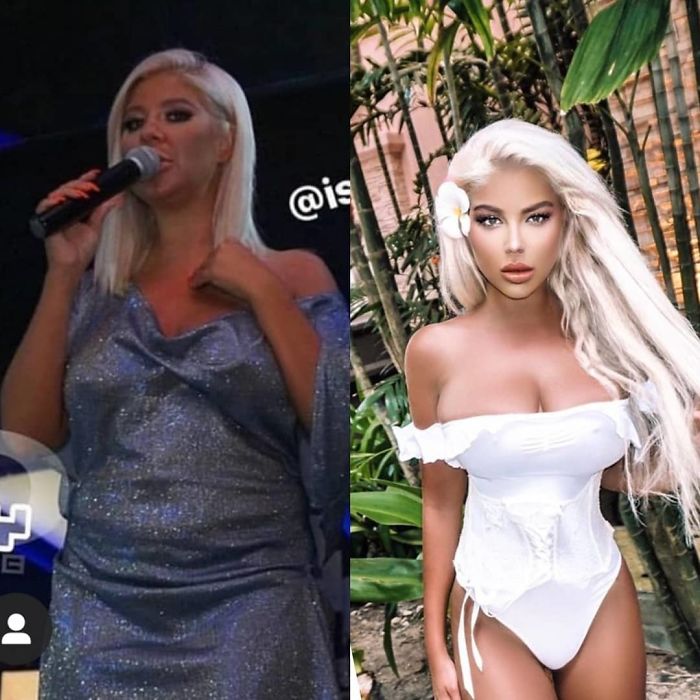 That's Not Face Correction, That's Face Transplantation