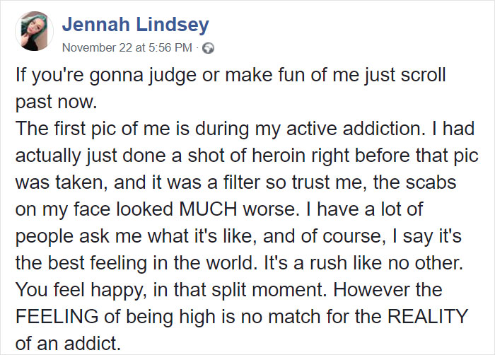 Ex-Addict Posts His Before & After Addiction Pics, Asks Others To Post Theirs As Well