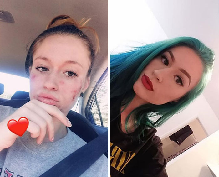 Ex-Addict Posts His Before & After Addiction Pics, Asks Others To Post Theirs As Well