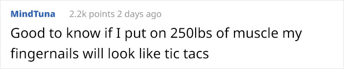 A Gorilla Born With A Lack Of Pigmentation On Her Fingers Surprises People