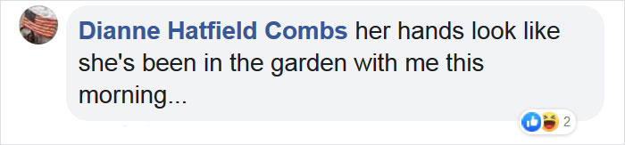 A Gorilla Born With A Lack Of Pigmentation On Her Fingers Surprises People