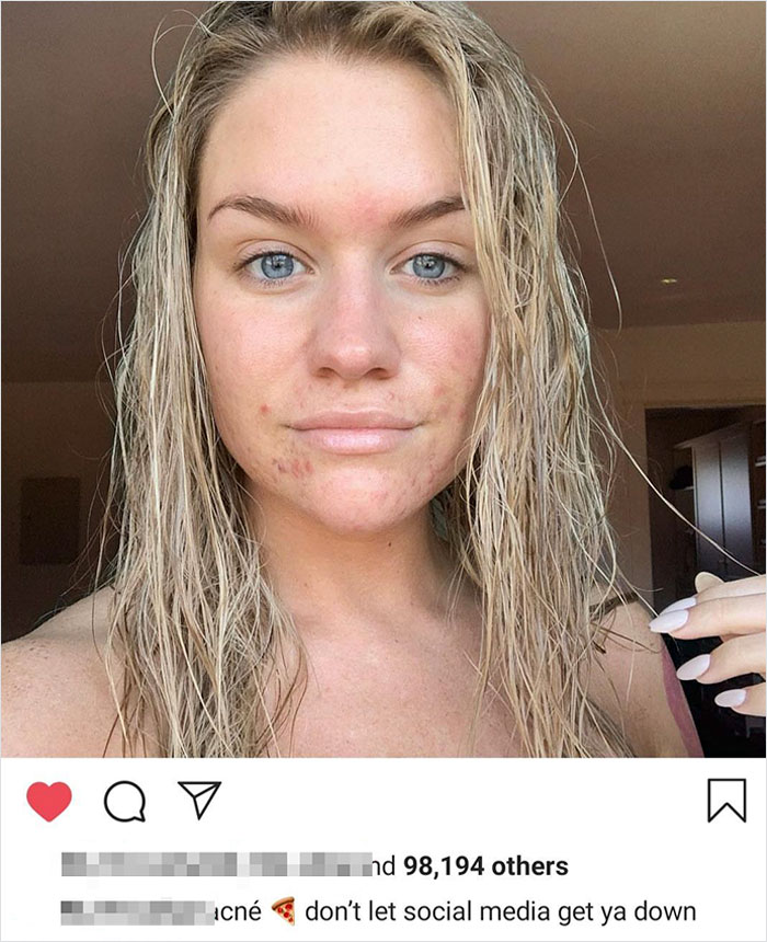 With Most People In The Beauty Influencer Industry Posting Images Photoshopped To Hell, Seeing An Artist Stop Editing Her Skin And Body Makes Me So Happy