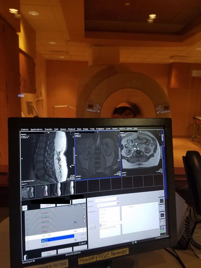 Proof That My Ex-Wife Was Wrong And That I Do, In Fact, Have A Spine