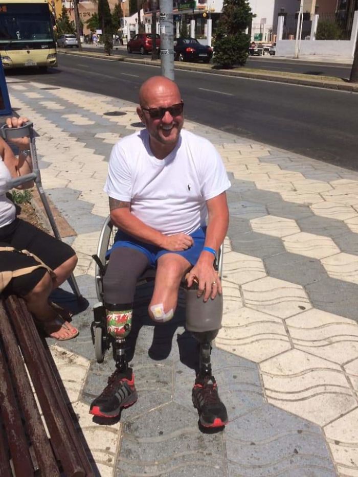 A Friend Of Mine Lost Both Of His Legs To Diabetes, But Not His Sense Of Humour