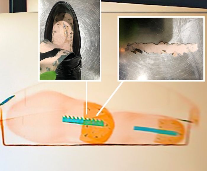 Razor Blades Like These Must Be Packed In Checked Bags