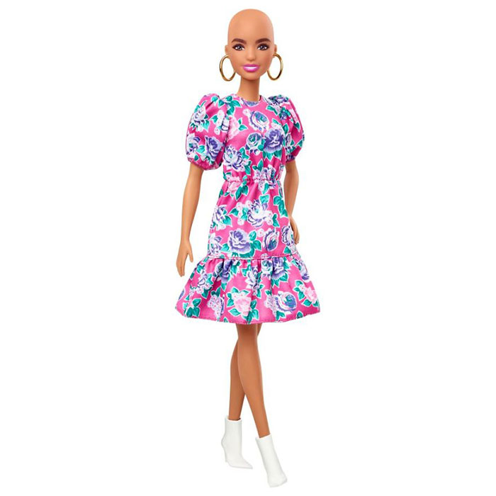 Barbie Celebrates Diversity By Creating Differently-Abled Dolls With Vitiligo And No Hair That Come In 35 Different Skin Tones