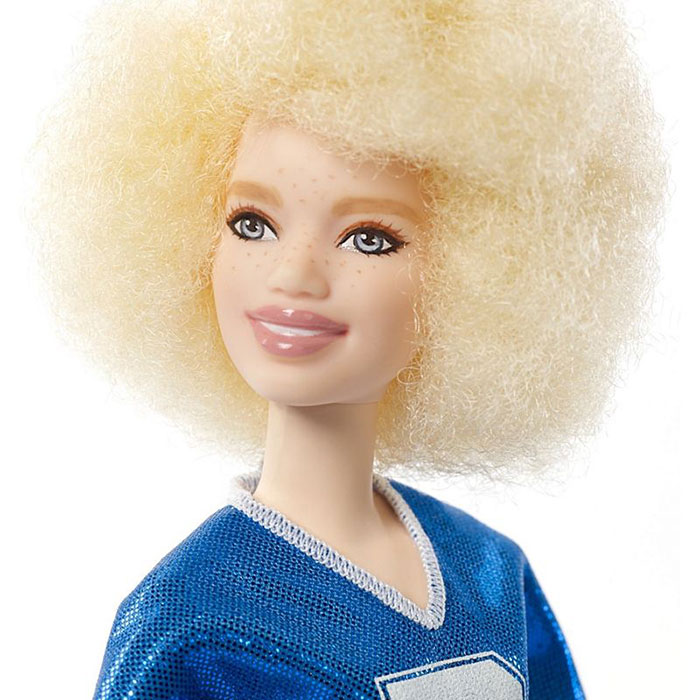 Barbie Celebrates Diversity By Creating Differently-Abled Dolls With Vitiligo And No Hair That Come In 35 Different Skin Tones Barbie Celebrates Diversity By Creating Differently-Abled Dolls With Vitiligo And No Hair That Come In 35 Different Skin Tones