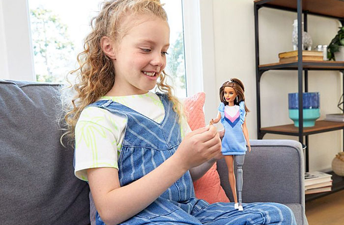Barbie Celebrates Diversity By Creating Differently-Abled Dolls With Vitiligo And No Hair That Come In 35 Different Skin Tones