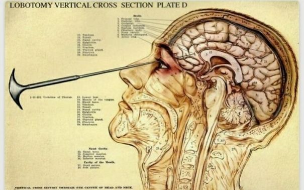 A Miraculous Nightmare