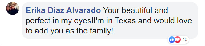 This Husky Who Was Rejected By A Breeder Because Of Her Funny Looks Is Now Going Viral