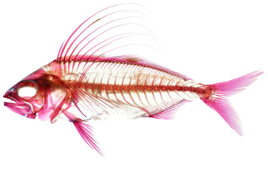 This Exhibition Really Gets Under My Skin