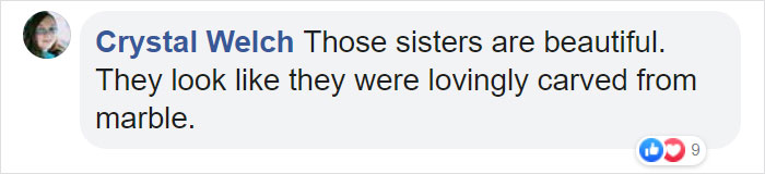 Albino Sisters Born 12 Years Apart Stun The World With Their Extraordinary Beauty (24 Pics)