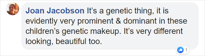 Albino Sisters Born 12 Years Apart Stun The World With Their Extraordinary Beauty (24 Pics)