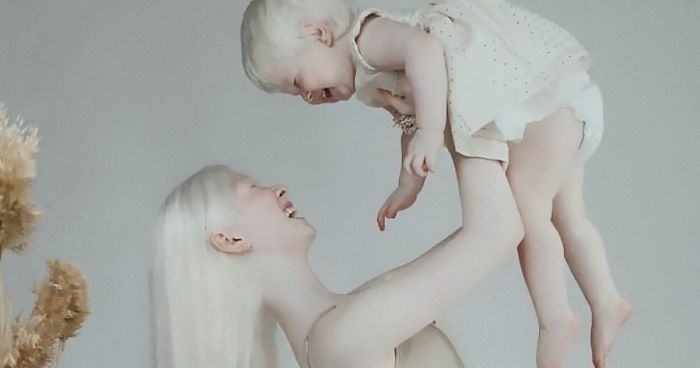 Albino Sisters Born 12 Years Apart Stun The World With Their Extraordinary Beauty (24 Pics)