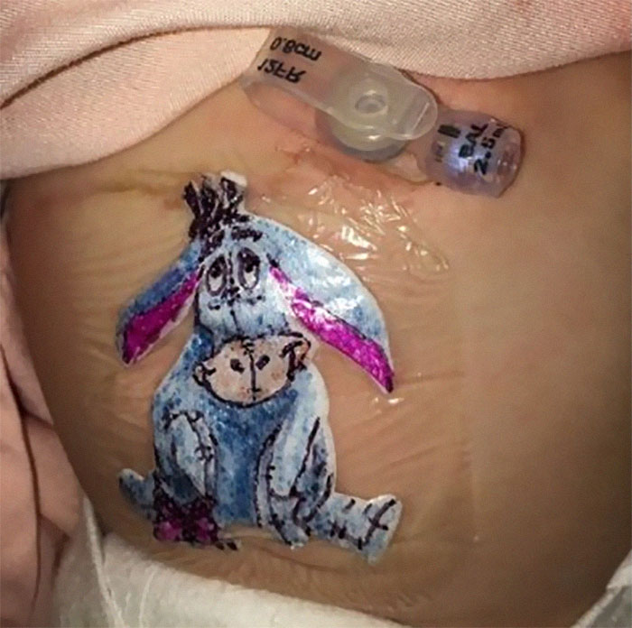 Wholesome Doctor Draws Cartoons On Kids' Post-Op Dressings Wholesome Doctor Draws Cartoons On Kids' Post-Op Dressings