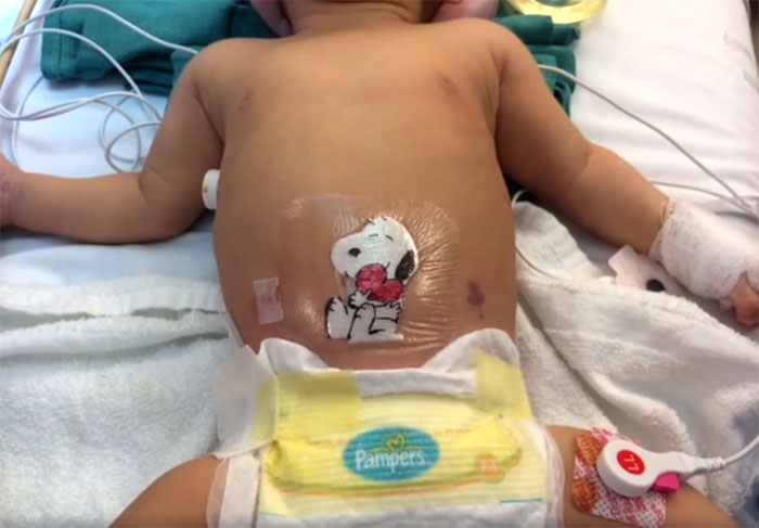 Wholesome Doctor Draws Cartoons On Kids' Post-Op Dressings