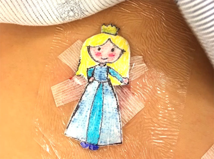 Wholesome Doctor Draws Cartoons On Kids' Post-Op Dressings Wholesome Doctor Draws Cartoons On Kids' Post-Op Dressings