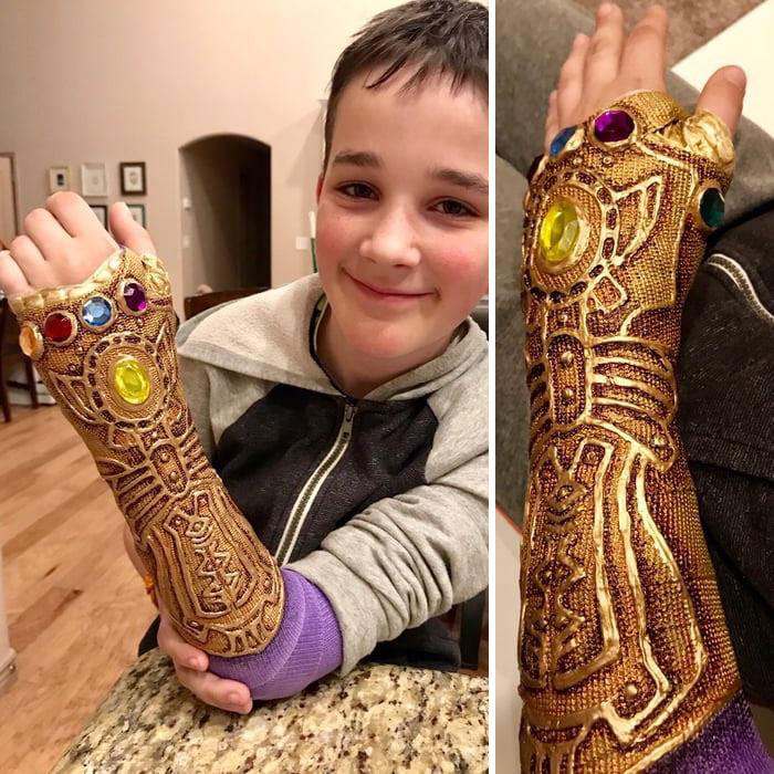 The Best Thing For A Broken Arm