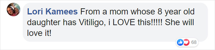 Barbie Celebrates Diversity By Creating Differently-Abled Dolls With Vitiligo And No Hair That Come In 35 Different Skin Tones