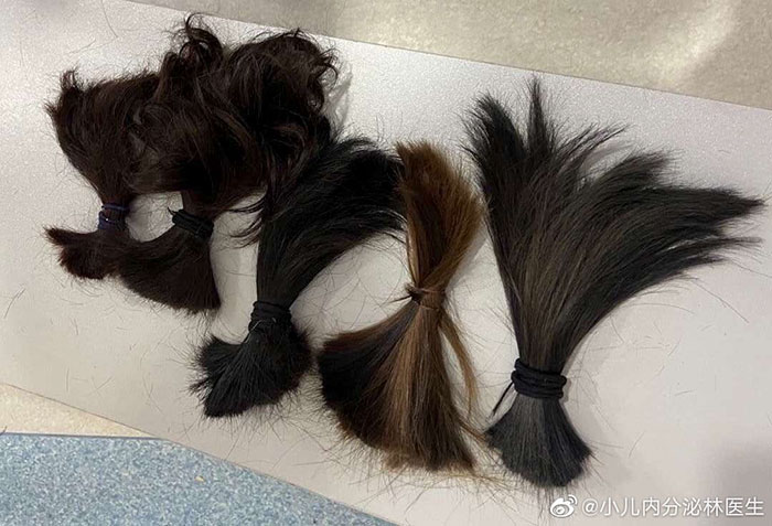 30 Pics That Show The Realities Of Medical Staff Working In Wuhan 30 Pics That Show The Realities Of Medical Staff Working In Wuhan