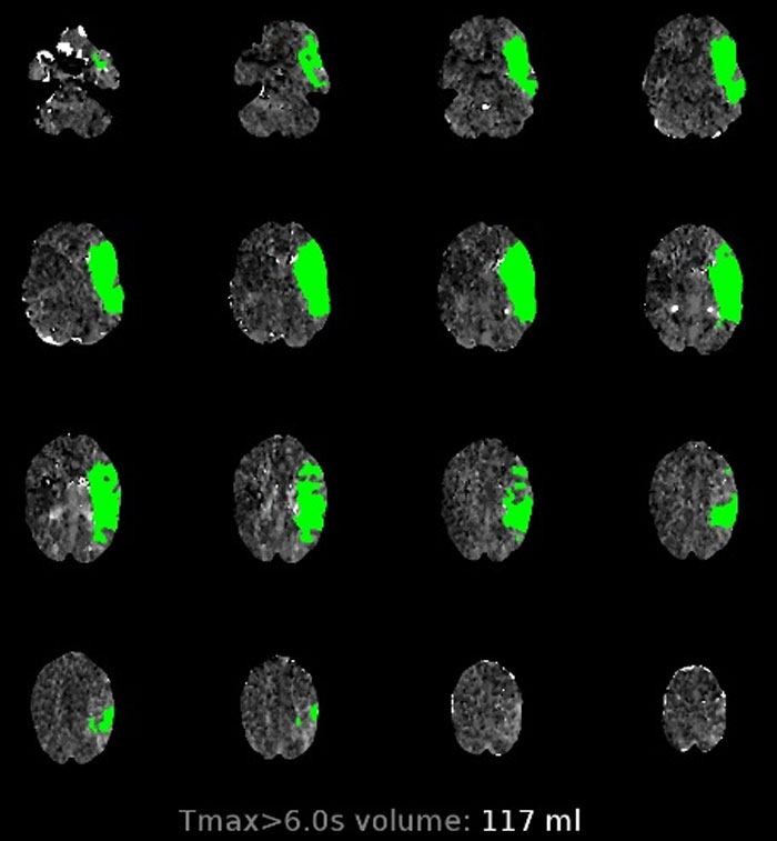 5-Year-Old Notices Mom Collapsing So She FaceTimes Her Dad, And People Are Saying The Family Would Be Broke If It Were The US 5-Year-Old Notices Mom Collapsing So She FaceTimes Her Dad, And People Are Saying The Family Would Be Broke If It Were The US