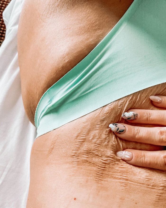 Someone Makes A Post About Strong Women Who Celebrate Their Natural Bodies, Illustrates It With The Perfect Example Someone Makes A Post About Strong Women Who Celebrate Their Natural Bodies, Illustrates It With The Perfect Example