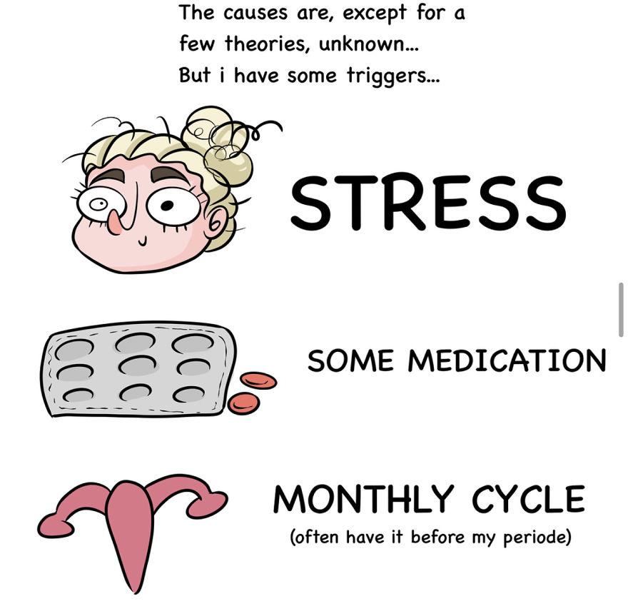 I Suffer From Exploding Head Syndrome, And Here's A Comic Explaining What It's Like
